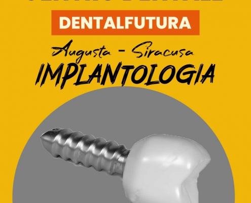 implantologia_augusta