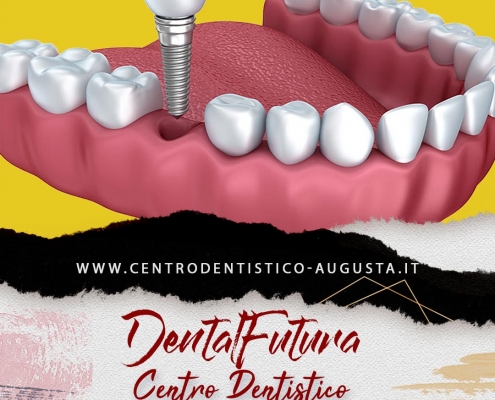 dentista_ad_augusta_apparecchio_per_denti_